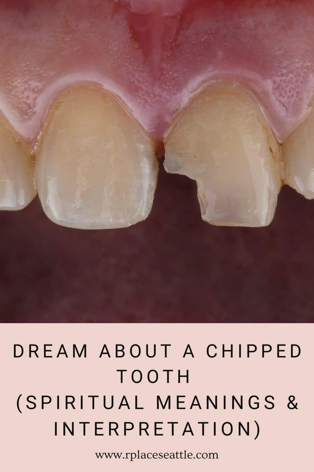Dream About A Chipped Tooth (Spiritual Meanings & Interpretation)